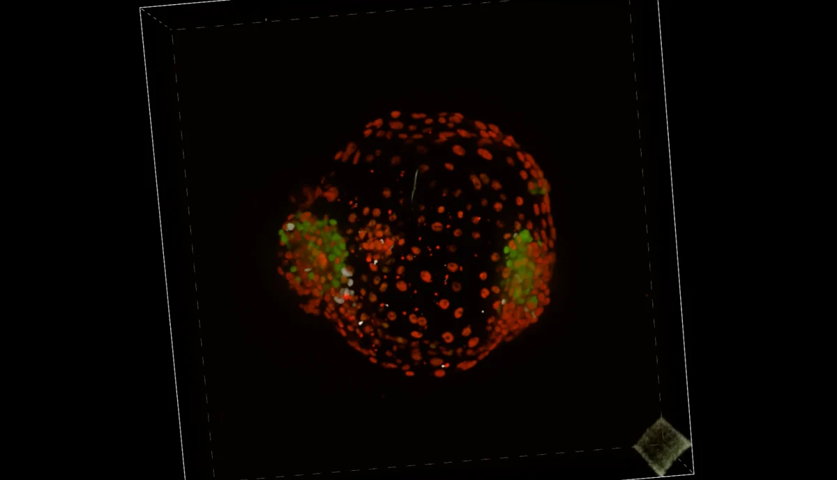 BMHC tweeling-embryo
